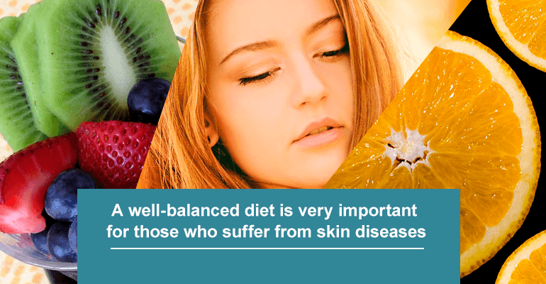 A well-balanced diet is very important for those who suffer from skin diseases