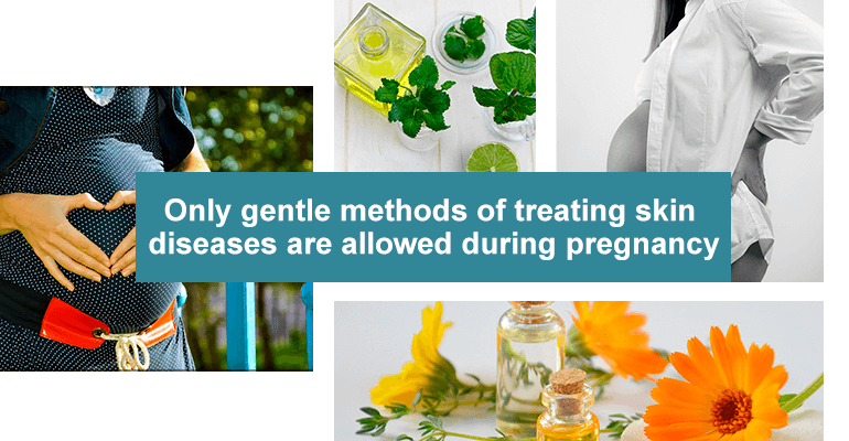 Only gentle methods of treating skin diseases are allowed during pregnancy